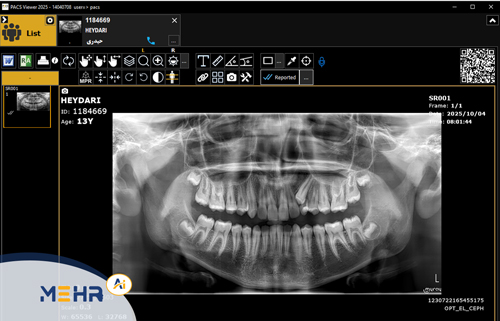 پکس رادیولوژی (Radiology PACS)