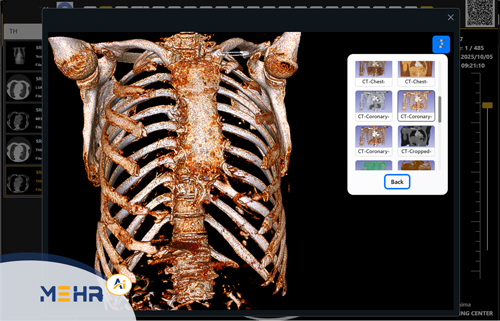 سه بعدی سازی تصاویر(3D Rendering of Medical Images)