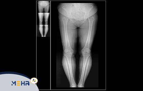 هوش مصنوعی در تصویربرداری پزشکی